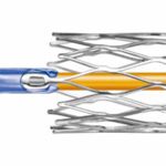 Stent visibility